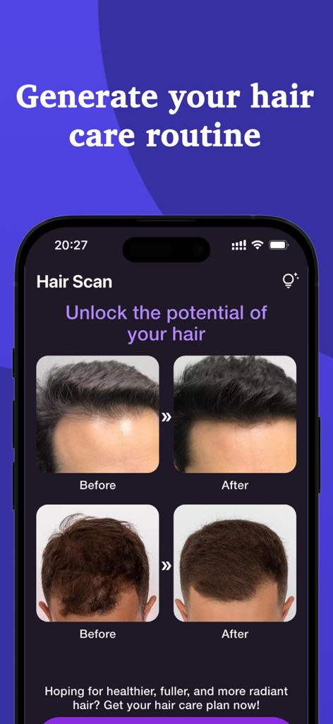 Hair Scan - Hair Snap Health - Mobile app screen displaying before and after photos of hair growth with a prompt to generate a personalized hair care routine.
