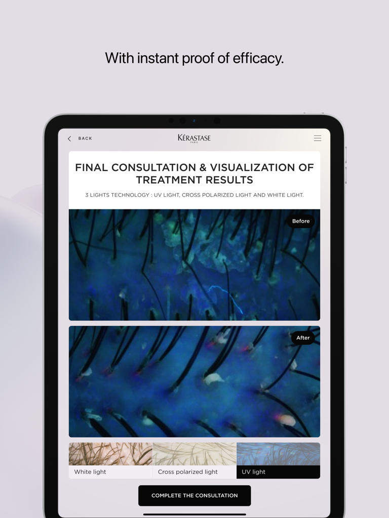 K-SCAN app showing before and after scalp analysis images for a hair treatment consultation