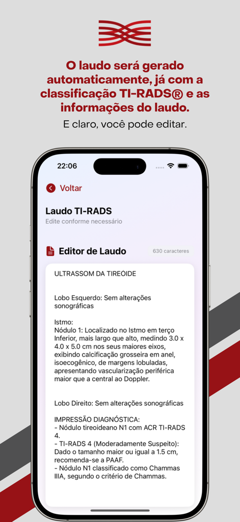 TI-RADS Calc - TI-RADS Calcアプリのインターフェース。診断的印象を含む、自動生成および編集可能な甲状腺超音波医療レポートが表示されます。