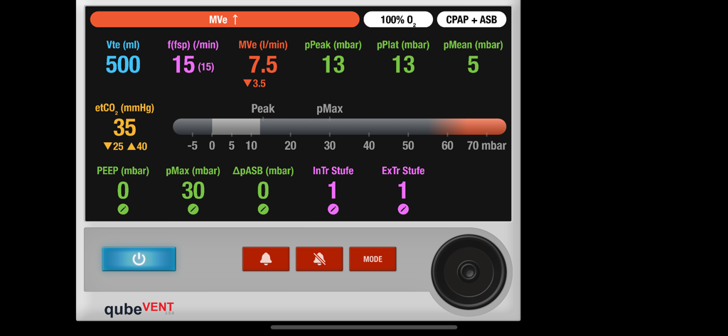 qubeVENT by SKILLQUBE - The qubeVENT app interface simulating a professional medical ventilator monitor with live respiratory data