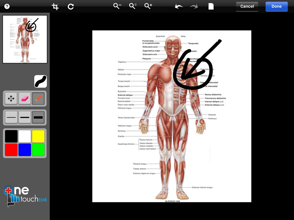 OneTouch EMR-Oberfläche, die ein anatomisches Diagramm mit Zeichenwerkzeugen für medizinische Anmerkungen zeigt