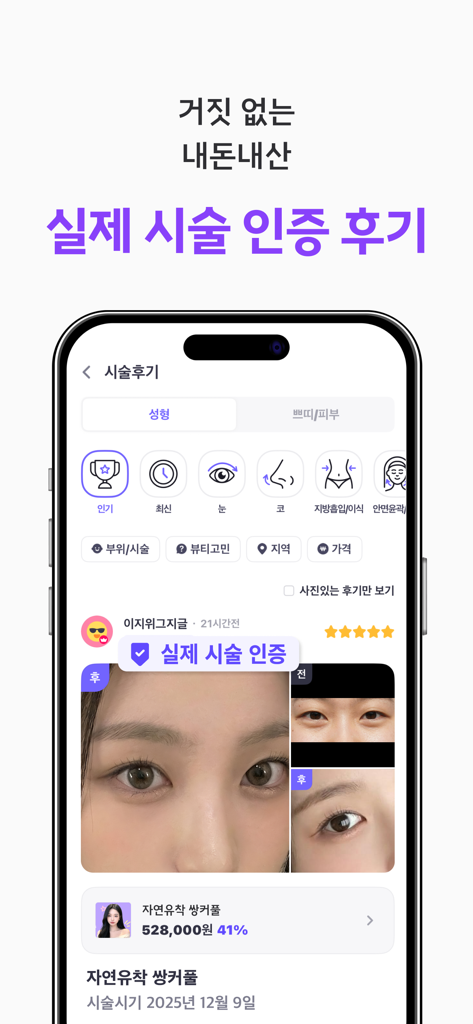 Babitalk app screen showing verified before and after photos of plastic surgery with pricing and reviews