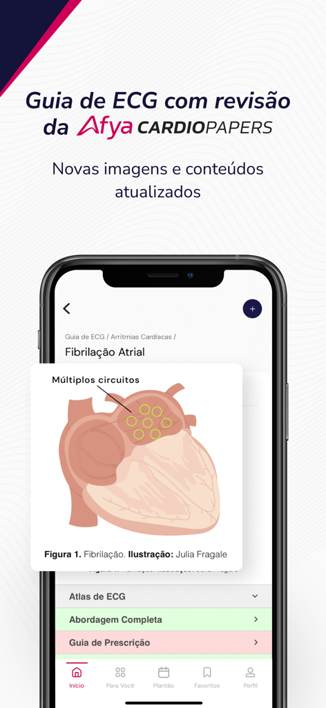 Afya Whitebook app screen showing an anatomical heart illustration for atrial fibrillation under the ECG guide section.