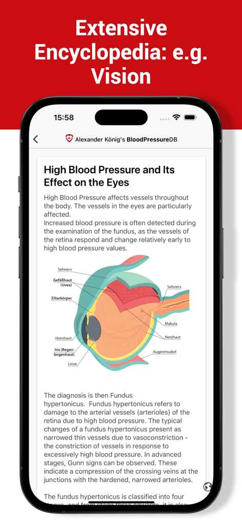 Blood Pressure DB - Log, Check - Lehrreicher Artikel in der Blutdruck DB App über die Auswirkungen von Hypertonie auf die Augen mit anatomischem Diagramm