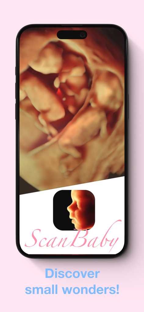3D ultrasound simulation of twins in the ScanBaby app