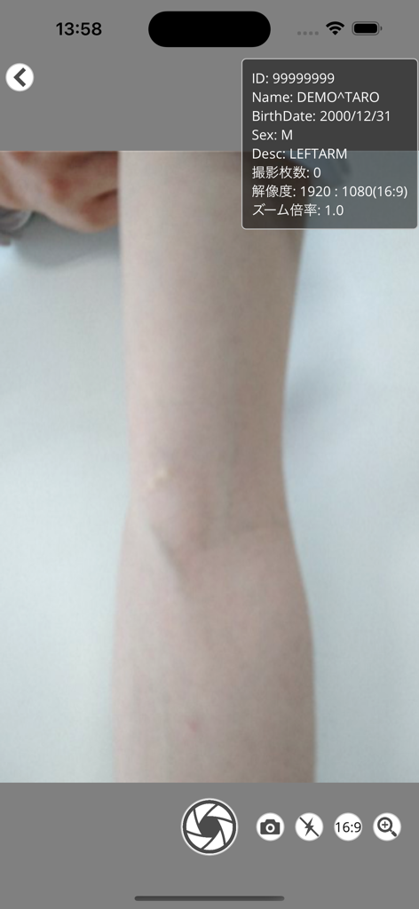 LiveShot2 - DICOM画像撮影 - LiveShot2 DICOM image capture screen with patient details overlay and camera controls