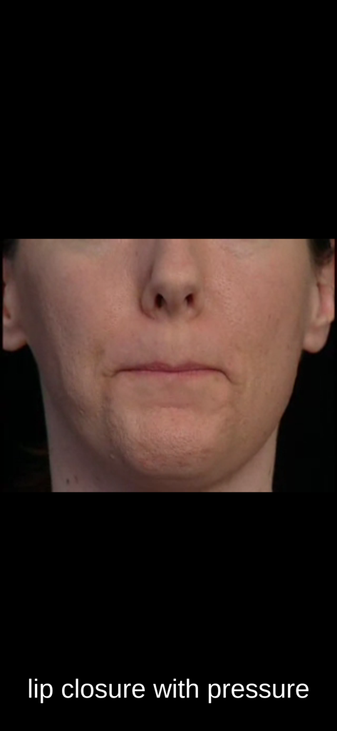 SmallTalk Oral Motor Exercises - Video demonstration of a lip closure with pressure exercise in the SmallTalk app