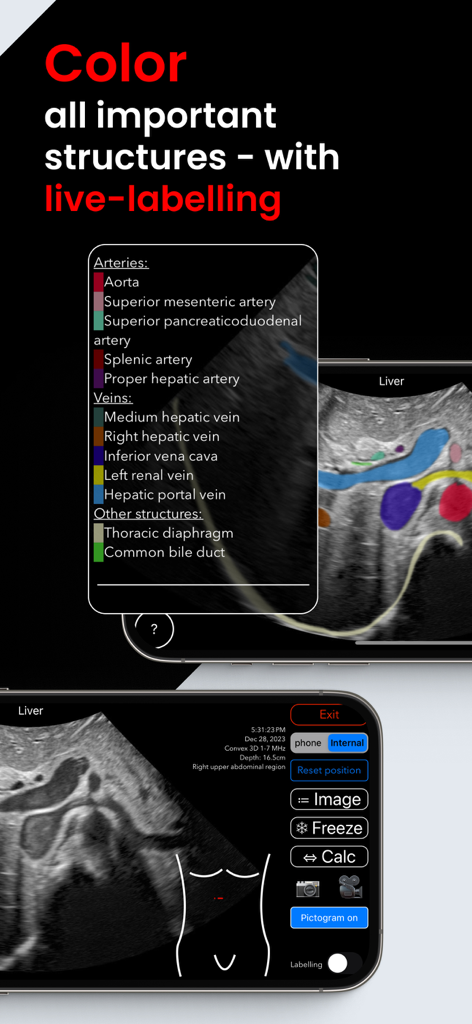 肝臓のスキャン中に解剖学的構造のライブカラーラベリングを表示するScanbooster Ultrasound Simインターフェース。