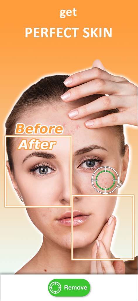 女性の顔の肌のシミ除去前後の比較