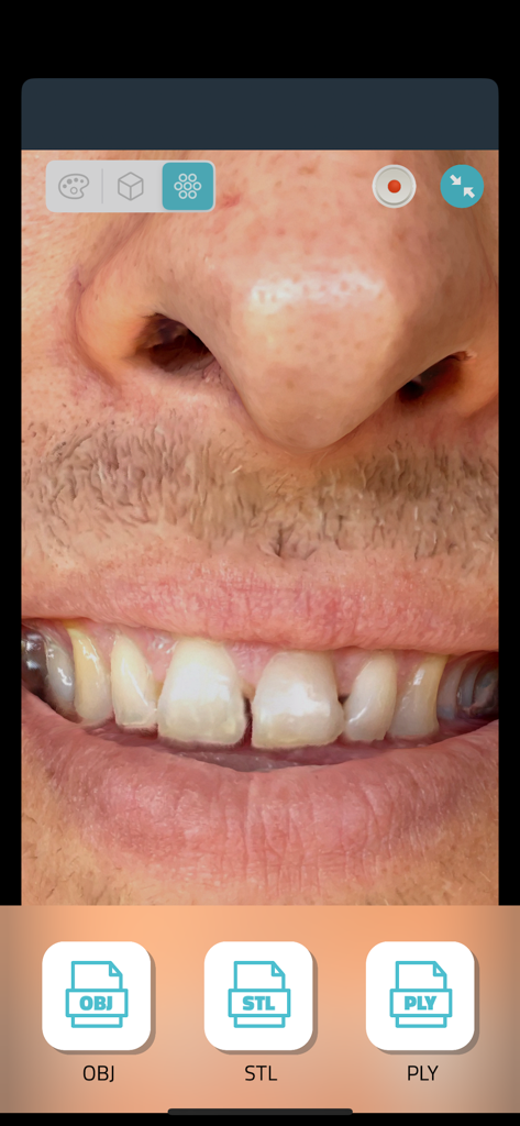 Qlone Dental Pro 3D Scanner - 3D face scan preview with OBJ STL and PLY export icons in the Qlone Dental Pro app