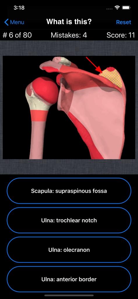 Anatomy Shoulder Quiz - Anatomy quiz interface showing a shoulder bone 3D model with an arrow pointing to the scapula supraspinous fossa and multiple choice answers.