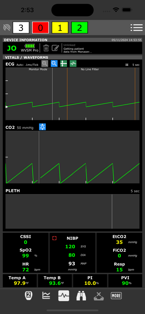 ADMS-App-Oberfläche, die Echtzeit-EKG-Kurven und Vitaldaten von Patienten mit farbkodierten Triage-Indikatoren anzeigt