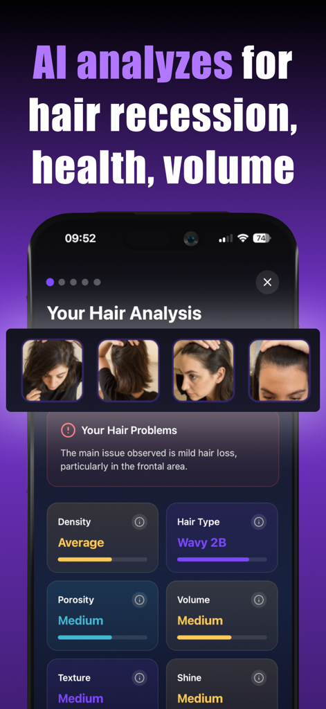 AI Hair Style&Care - HairMaxx - HairMaxx mobile app screen showing AI hair analysis for recession health and volume with detailed metrics