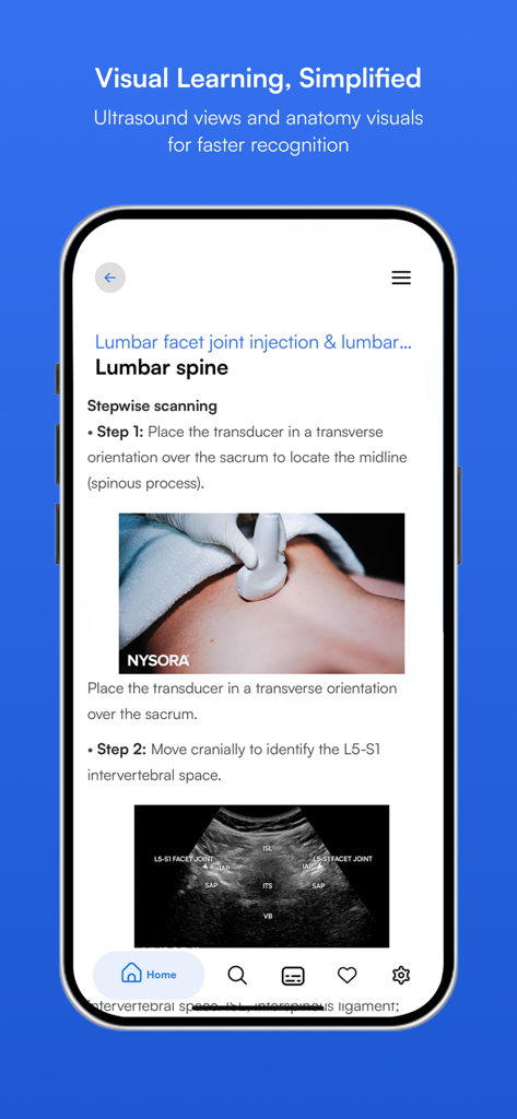 NYSORA Ultrasound Pain - Schritt-für-Schritt-Anleitung für Ultraschalluntersuchungen der Lendenwirbelsäule in der NYSORA-App