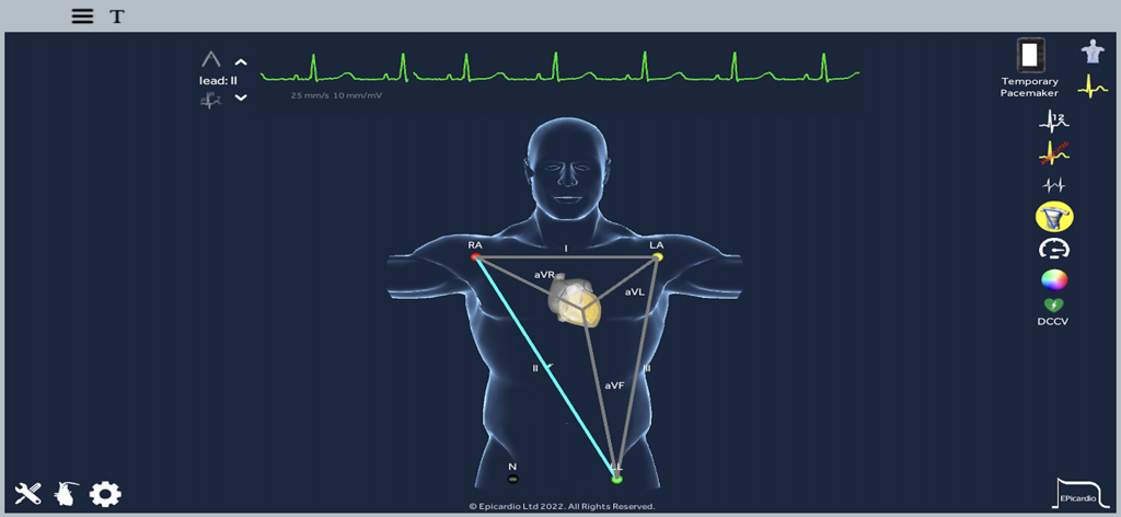 A 3D human torso model showing heart anatomy and ECG lead placements with Einthoven's triangle.