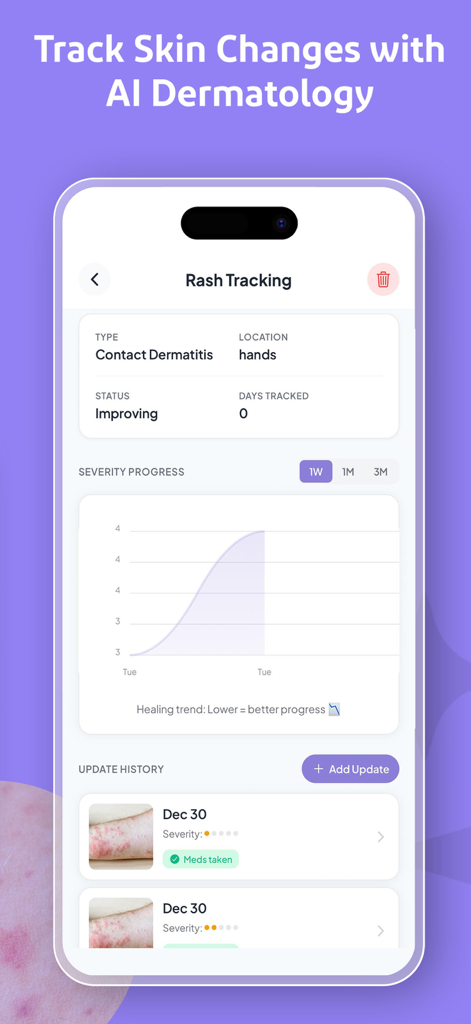 Mobile app interface showing skin rash tracking with a severity progress graph and history log for contact dermatitis