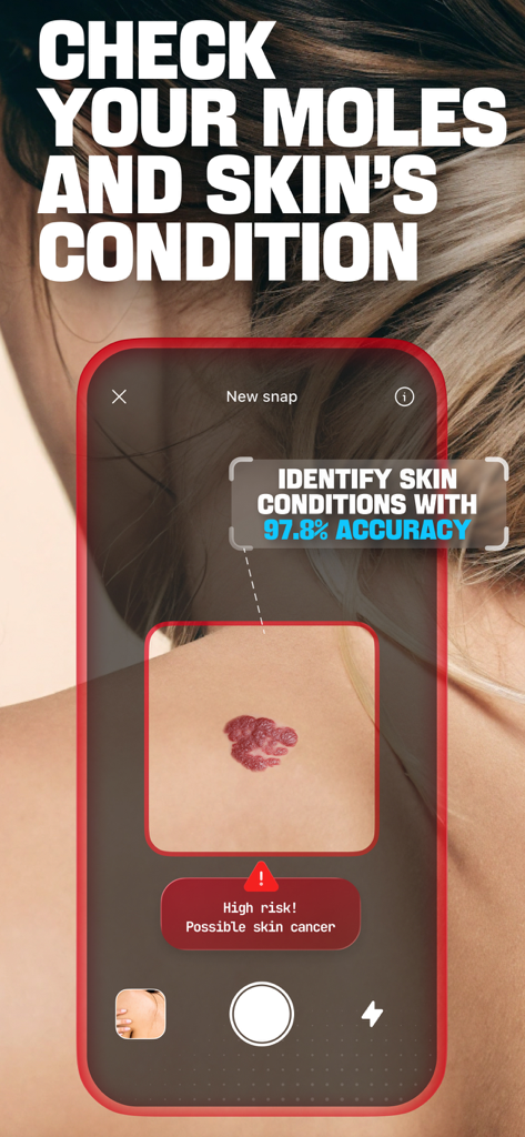 DermaScan - AI dermatologist - Interfaz de la aplicación móvil DermaScan escaneando un lunar e identificando un alto riesgo de cáncer de piel utilizando IA.