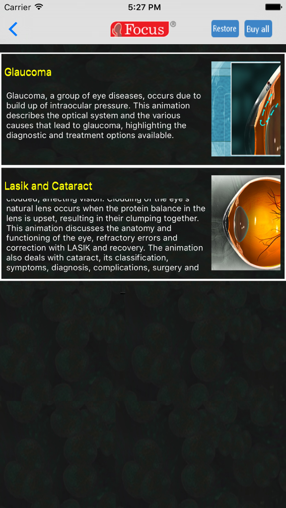 Educational screen showing descriptions and diagrams of glaucoma and cataracts.