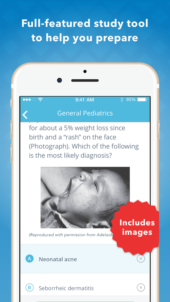 USMLE Pediatrics PreTest - Un smartphone que muestra una pregunta de práctica de USMLE Pediatrics PreTest sobre acné neonatal con una fotografía clínica de un bebé.