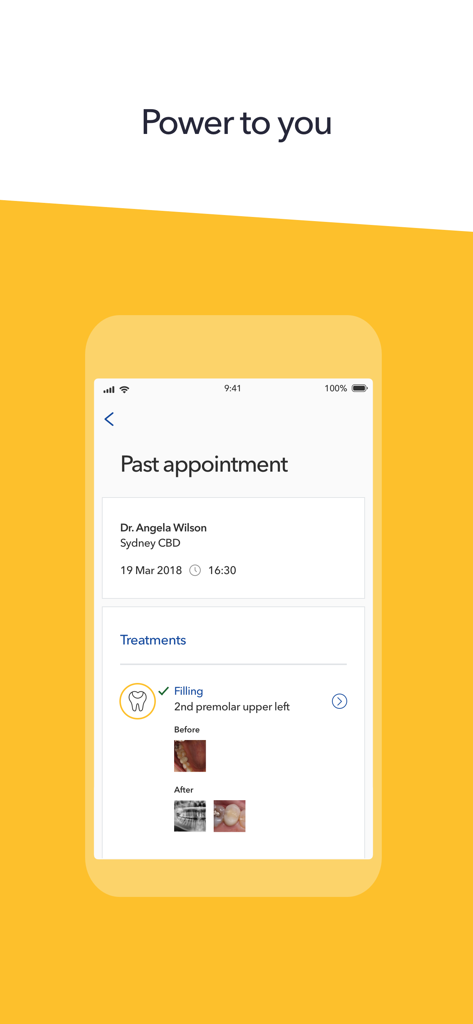 Dental 99 app screen showing past appointment details including treatment type and before and after photos