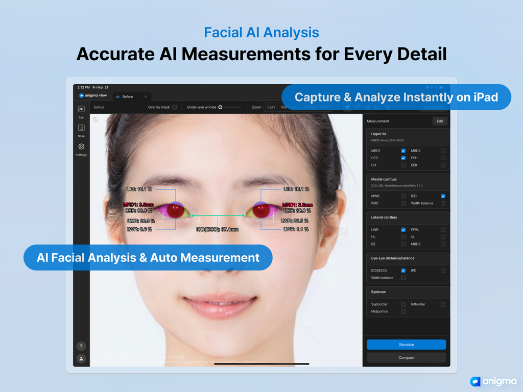 Anigma View - Anigma View app interface displaying automated AI facial measurements and analysis on iPad