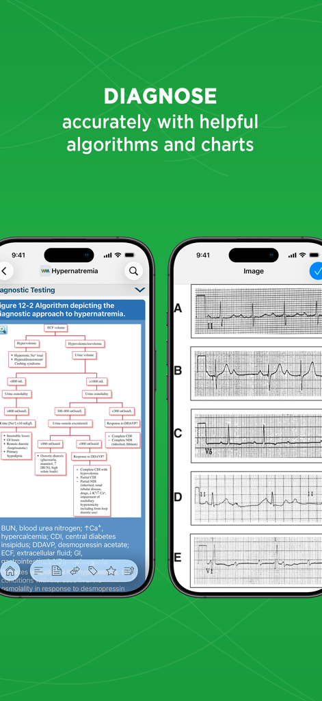 Pantallas de aplicaciones médicas que muestran un diagrama de flujo de diagnóstico de hipernatremia y varios gráficos de ECG.