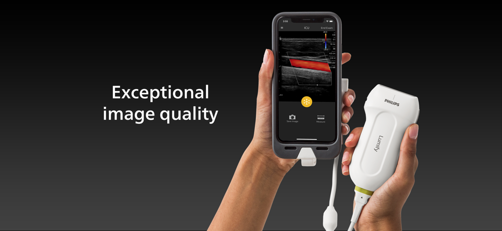 A person holding a Philips Lumify ultrasound transducer and a smartphone displaying a high resolution medical scan
