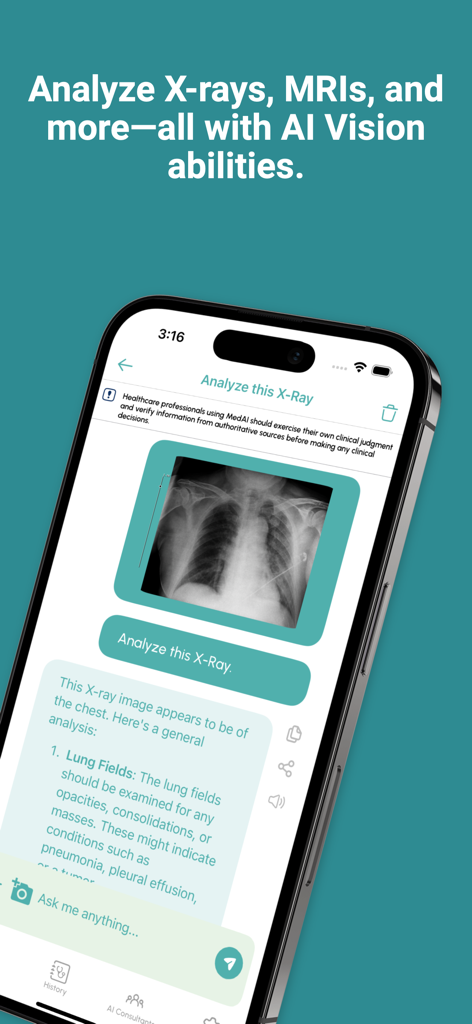 MedAI: Pro AI Doctor Assistant - A smartphone displaying the MedAI app using AI Vision to analyze a chest X-ray for healthcare professionals
