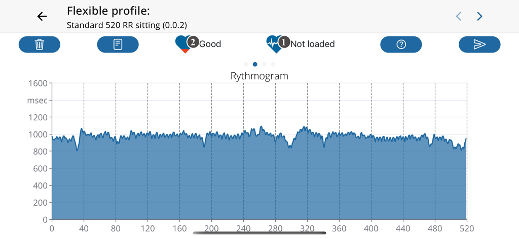 HRV-Analysis - Graphique de rythmogramme affichant les intervalles de battements cardiaques dans l'application mobile HRV Analysis.