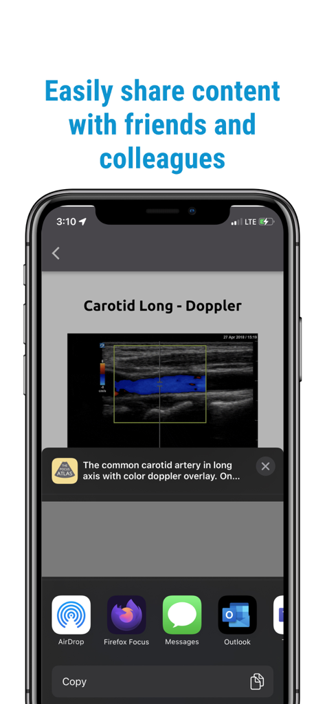 The POCUS Atlas app interface showing the share menu for a carotid artery ultrasound image