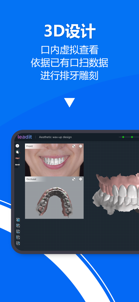 Interfaz de diseño dental 3D mostrando escaneos intraorales y maquetas de sonrisas de pacientes en Smile Design Pro.