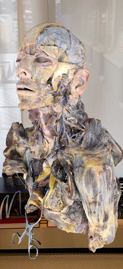 Medicalholodeck® - Medicalholodeckでの頭頸部の3D人体解剖 dissection