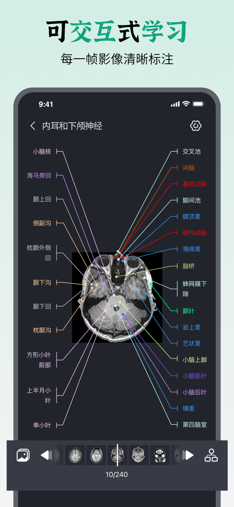 A medical app displaying a detailed cross-section MRI image of the human head with multiple anatomical labels for interactive study.