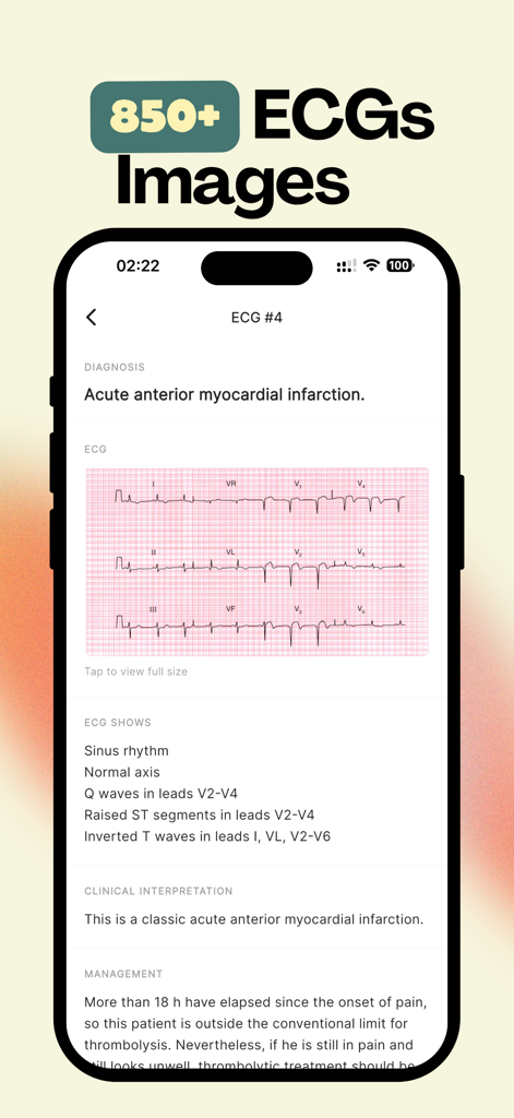 MedDose Pro - MCQs & Diseases - MedDose Pro mobile app displaying an ECG case study and medical diagnosis