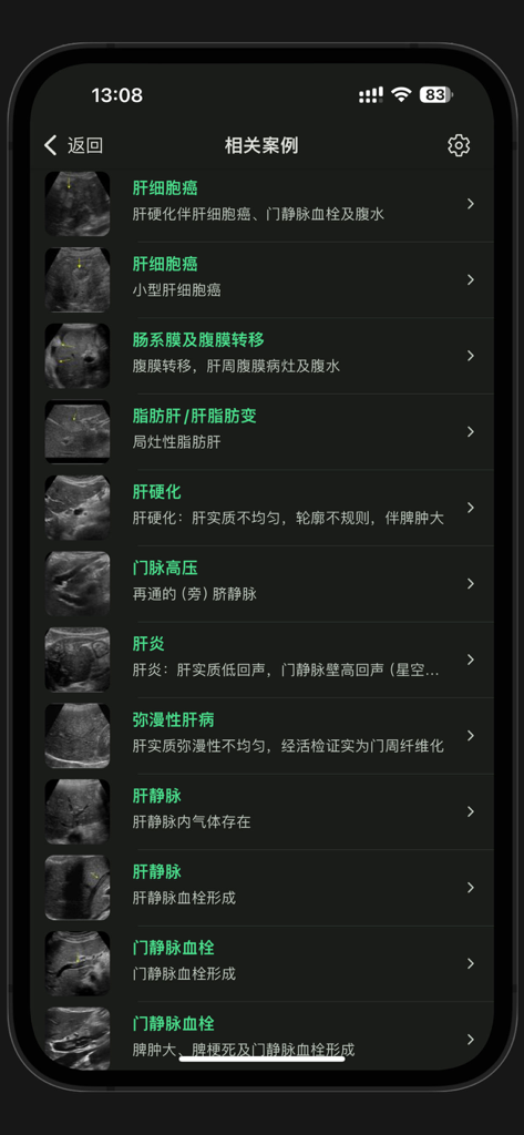 A list of clinical ultrasound case studies showing various liver conditions and diagnostic images in a medical learning app