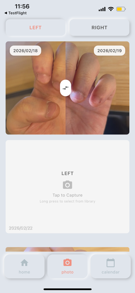nailgrow - The nailgrow app displaying side by side photos of nail growth progress over time