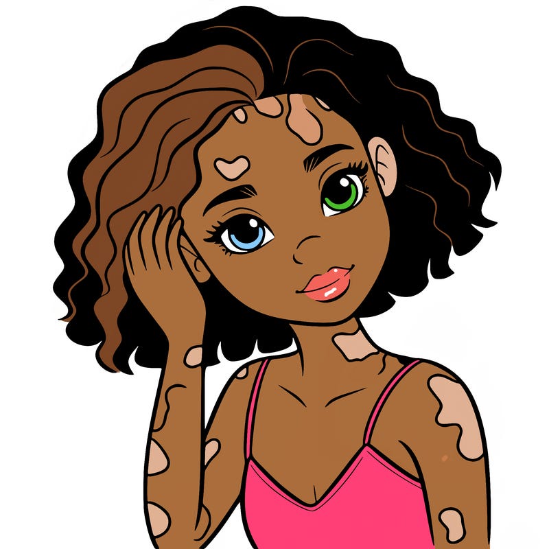vitiligo black girl