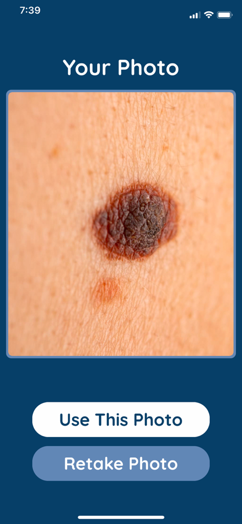 Dermos - Dermos app screen showing a close up photo of a skin lesion with buttons to use or retake the photo