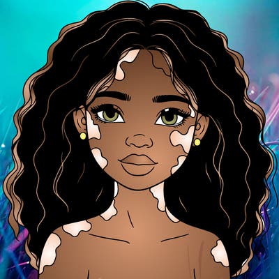 beautiful black girl with vitiligo