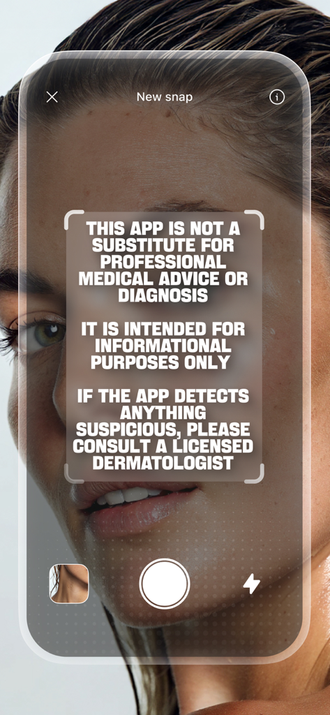 DermaScan - AI dermatologist - Interfaz de cámara de la aplicación DermaScan mostrando un descargo de responsabilidad médica prominente superpuesto en el rostro de un usuario.