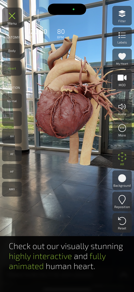 INSIGHT HEART - A highly detailed 3D human heart model displayed in augmented reality with medical navigation menus