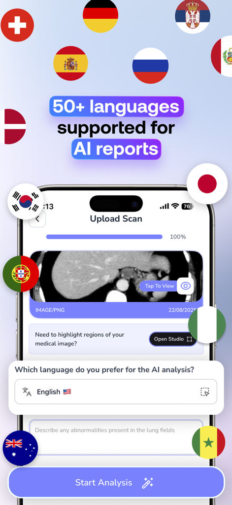 AI Doctor & Radiology-Med Scan - MedScan AI mobile app screen showing language selection for AI medical reports