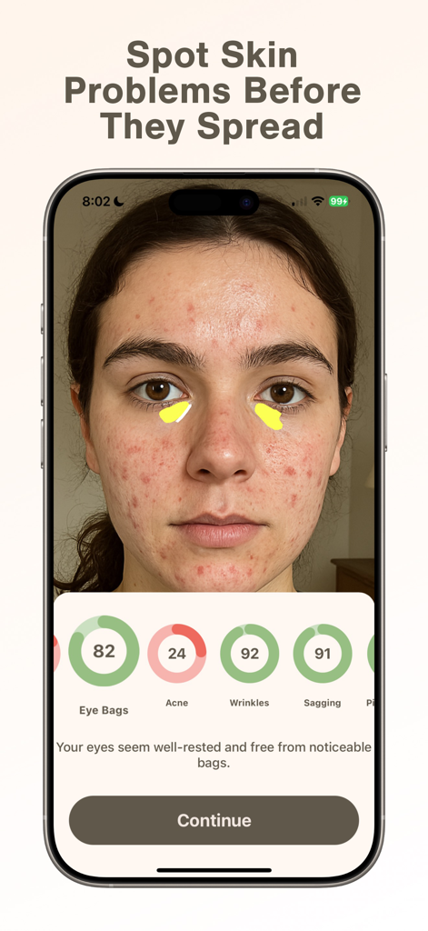 Skan - AI Skincare and Beauty - Skan app AI facial scan analyzing skin problems like acne and wrinkles