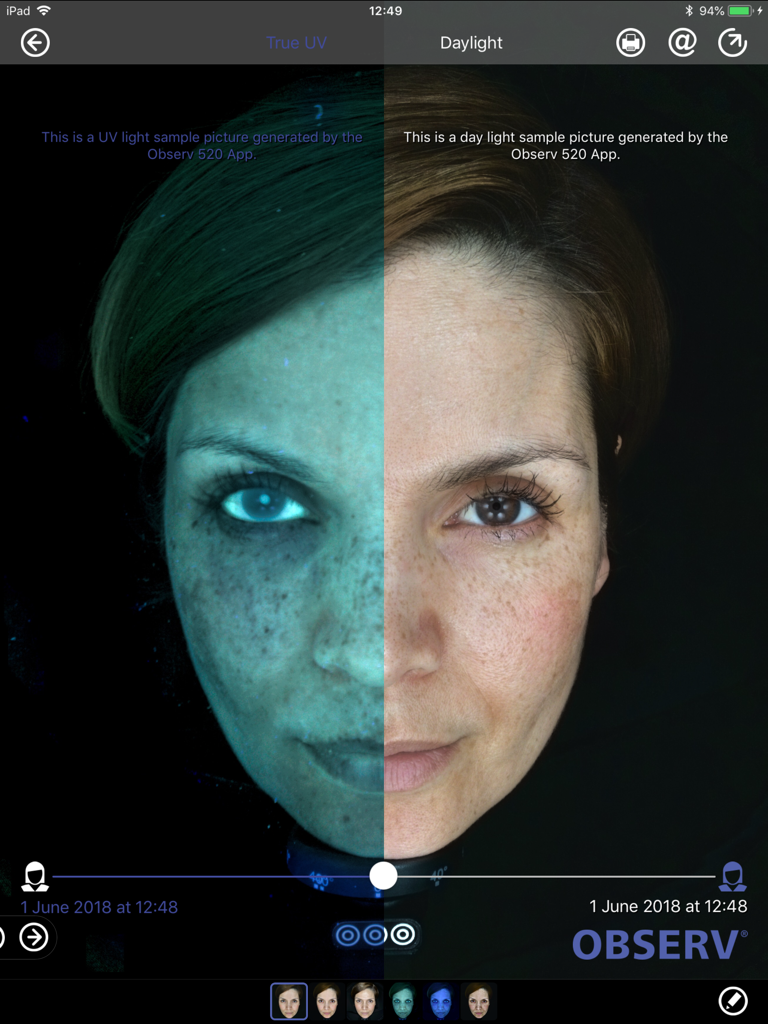 OBSERV 520 - Split screen comparison of a woman's face showing True UV and Daylight skin analysis modes on the OBSERV 520 app