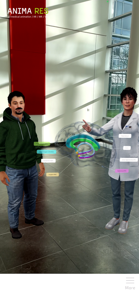 医療トレーニング用の解剖学的ラベル付き3D脳ホログラムの拡張現実デモンストレーション