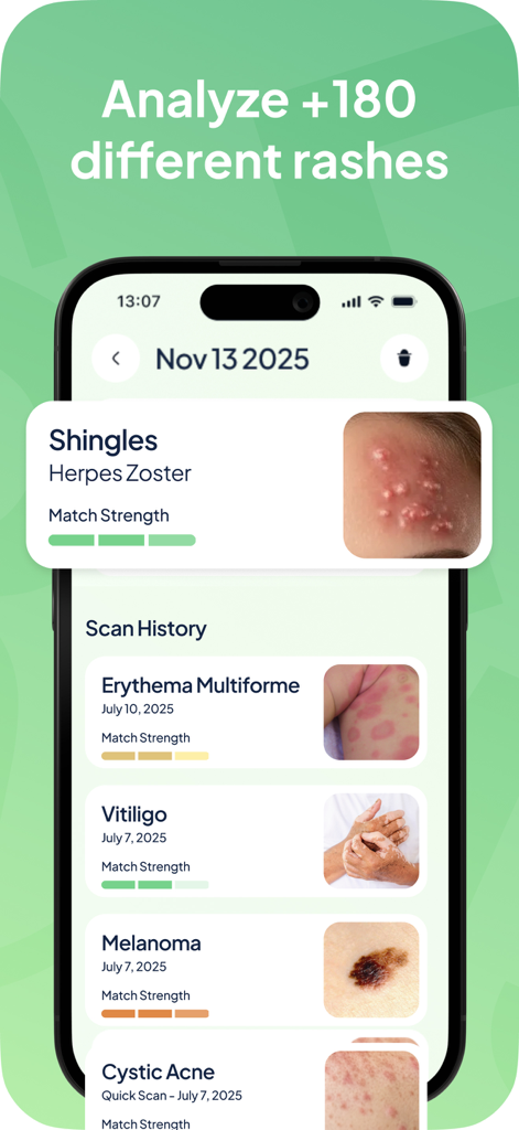 Rash ID: Skin Rash Identifier - A smartphone screen displaying a history of identified skin rashes like shingles and melanoma.