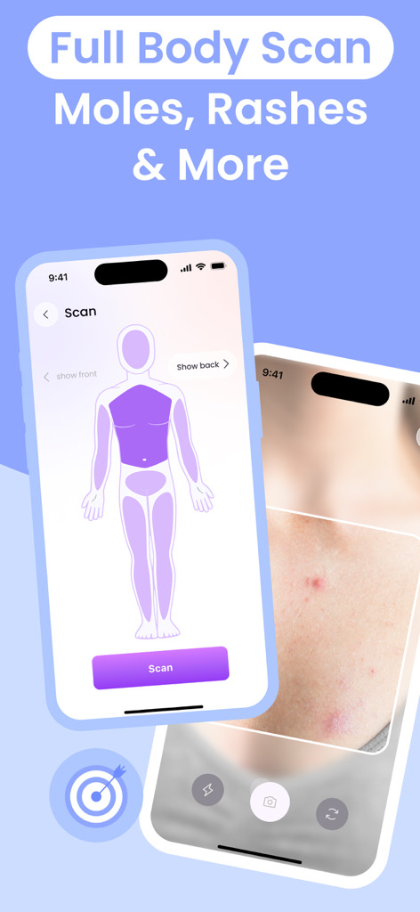 Interfaz de la aplicación Escáner de Piel IA que muestra el escaneo del mapa corporal completo y el análisis de cámara para lunares y erupciones.
