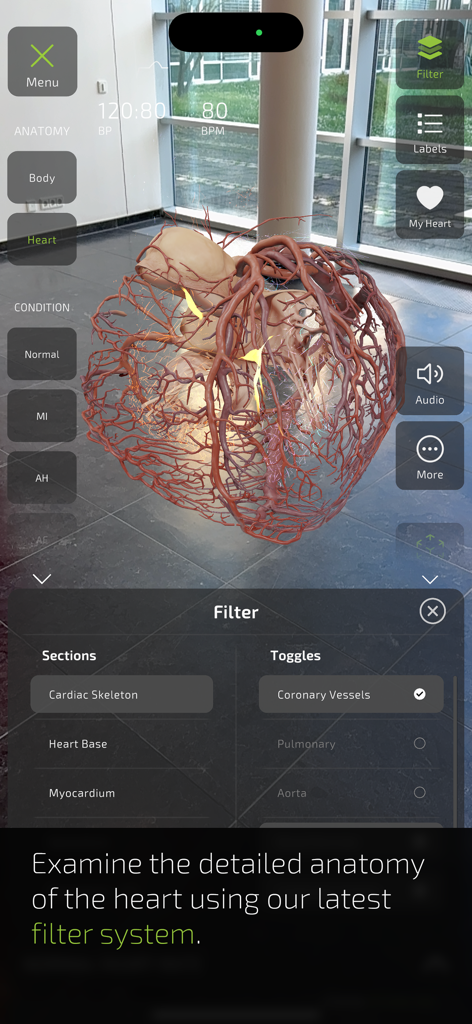 3D augmented reality heart model with an interactive anatomy filter menu in the INSIGHT HEART app