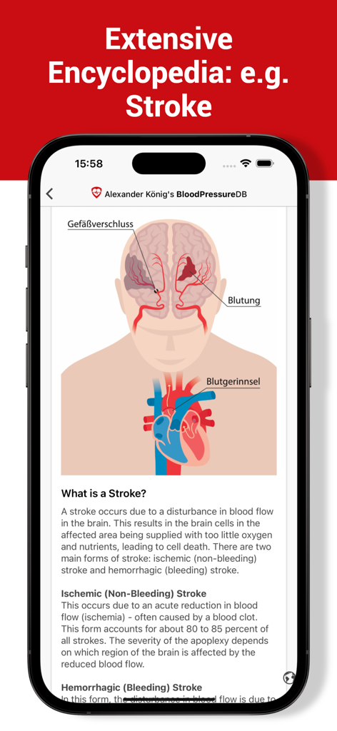 Blood Pressure DB - Log, Check - Bildschirm einer mobilen App mit einem medizinischen Lexikon-Eintrag über Schlaganfälle mit Gehirn- und Herzdiagrammen.