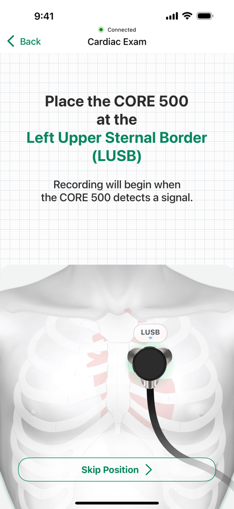 SENSORA™ by Eko Health - Tela do aplicativo SENSORA demonstrando a colocação do estetoscópio na borda esternal superior esquerda